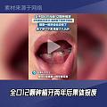 种牙需谨慎