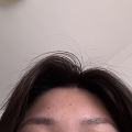 到底要不要点痦子