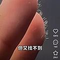 前几天旅游，住宿时候被酒店窗帘咬了