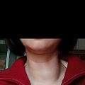 甲状腺问题慎入。记录一下我的中医治疗经过。